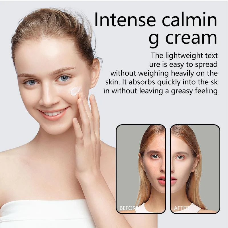 Buy Anua Heartleaf 70% Intense Calming Cream in Pakistan
