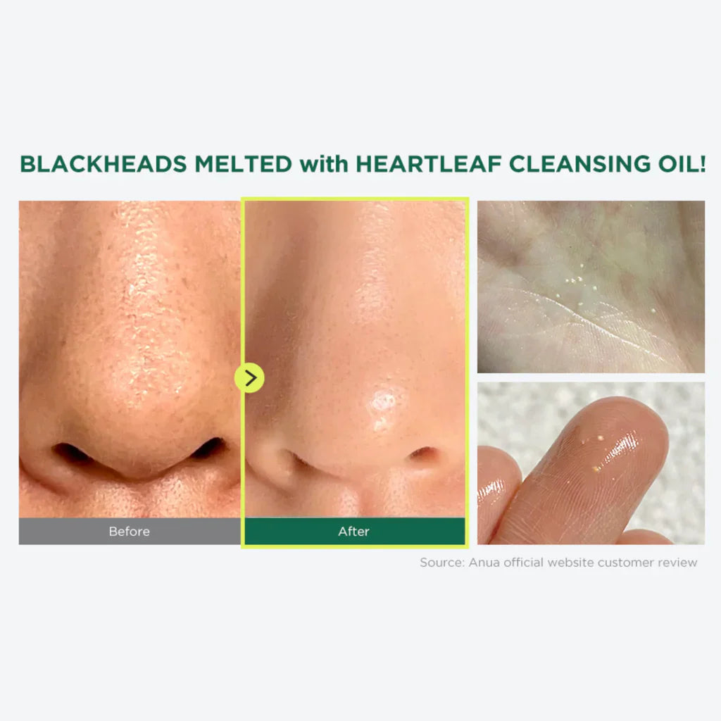 Buy Anua Heartleaf Pore Control Cleansing Oil in Pakistan