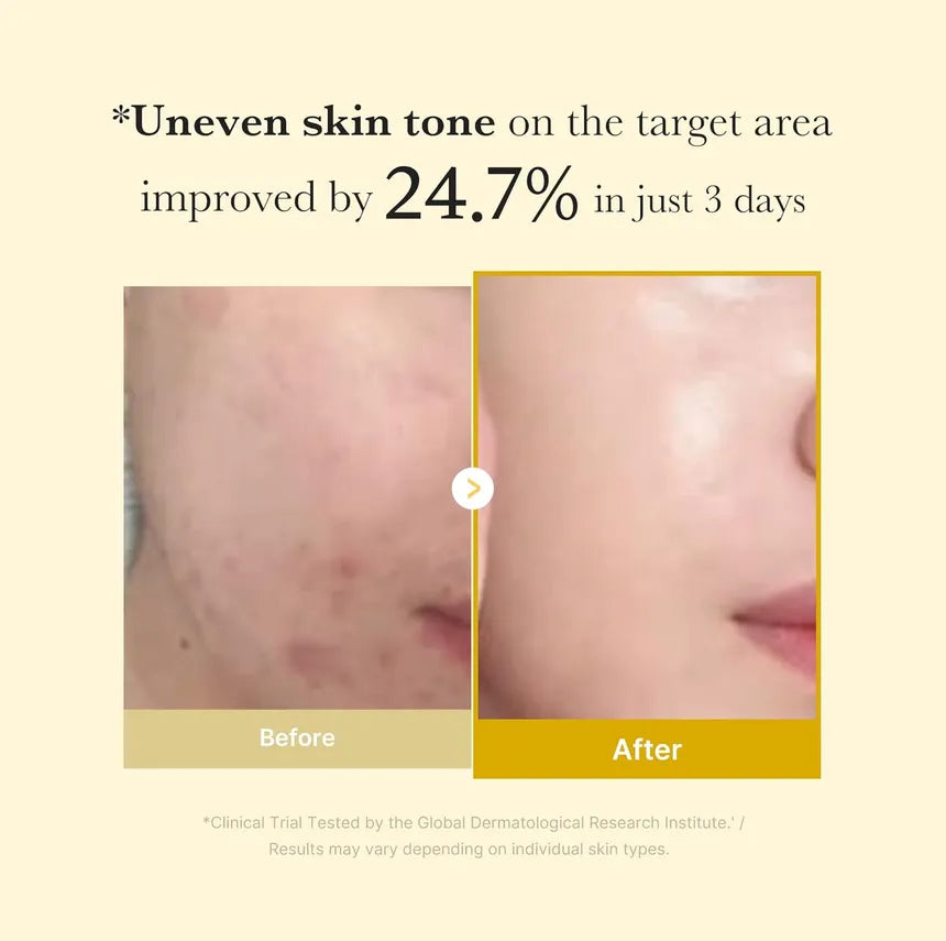 Buy Medicube - Kojic Acid Turmeric Night Wrapping Mask - 75ml in Pakistan