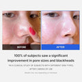Buy Medicube Zero Pore Pad 2.0 (70pcs) in Pakistan