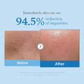 Buy Medicube Zero Pore Blackhead Deep Cleansing Oil in Pakistan