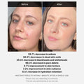 Buy Medicube Red Acne Succinic Acid Peel in Pakistan
