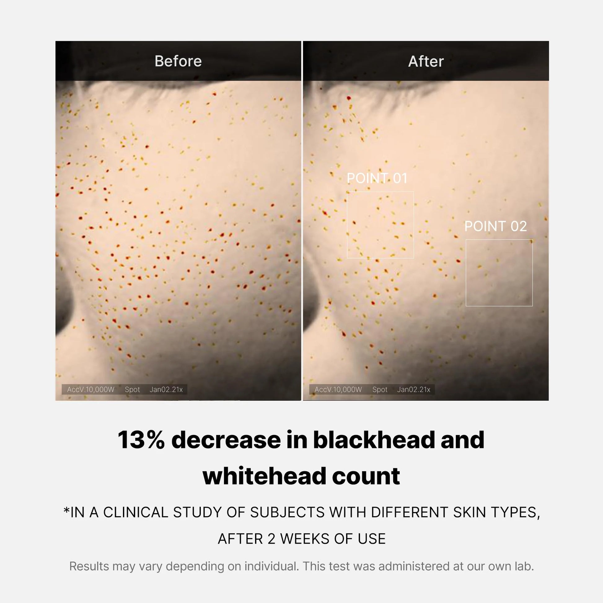 Buy Medicube Zero Pore One Day Serum in Pakistan