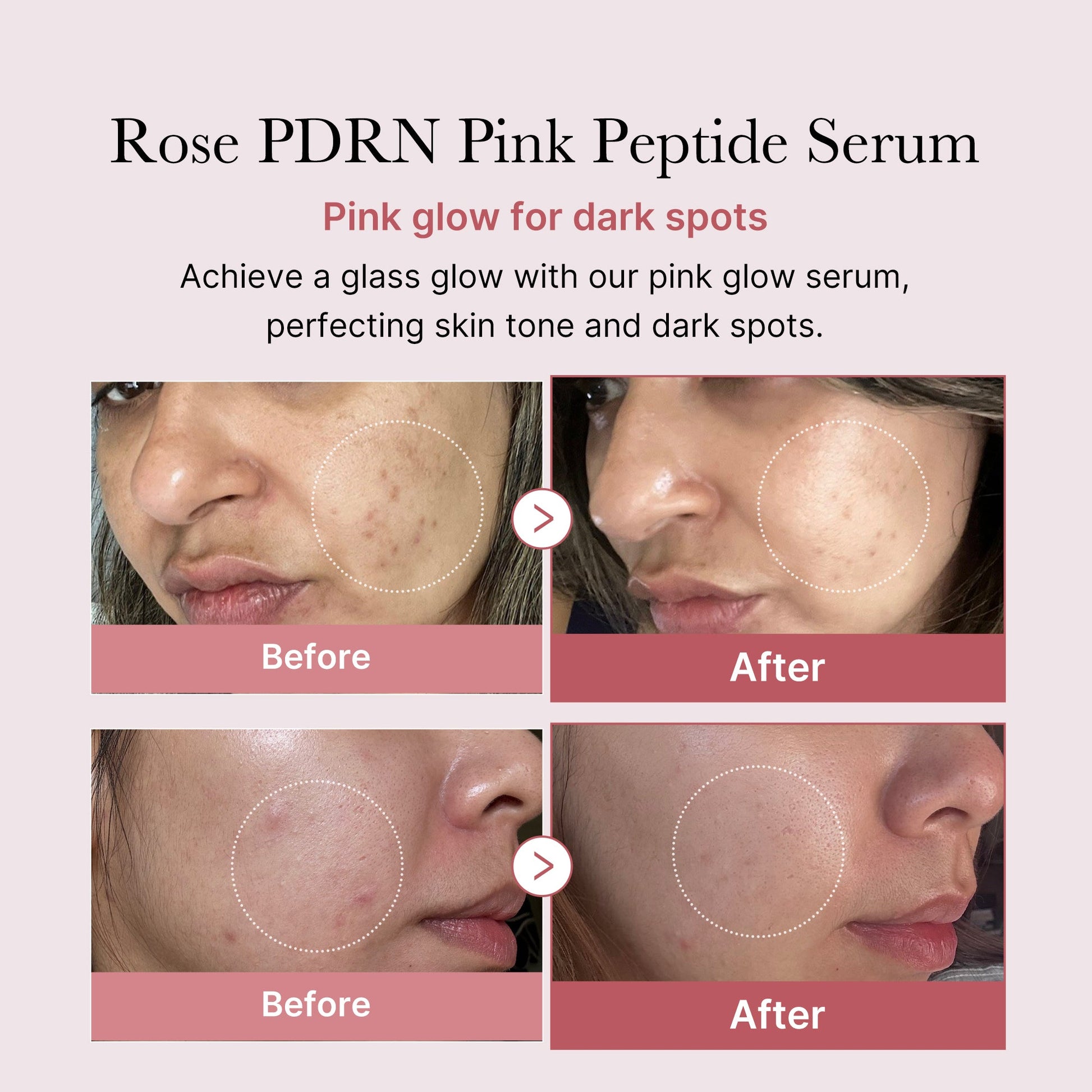 Buy Medicube PDRN Pink Peptide Serum - 30ml in Pakistan