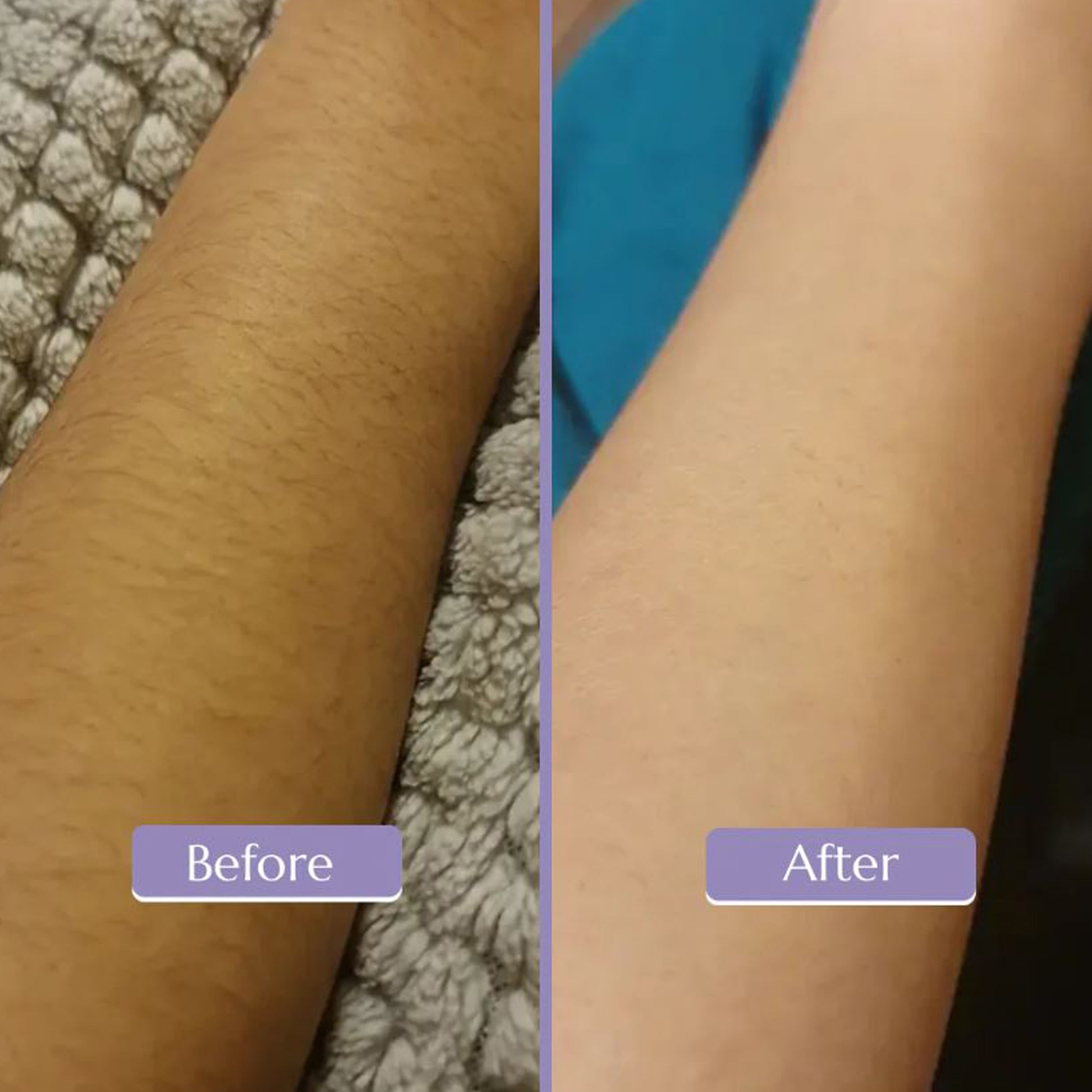 Buy Crystal Hair Eraser in Pakistan