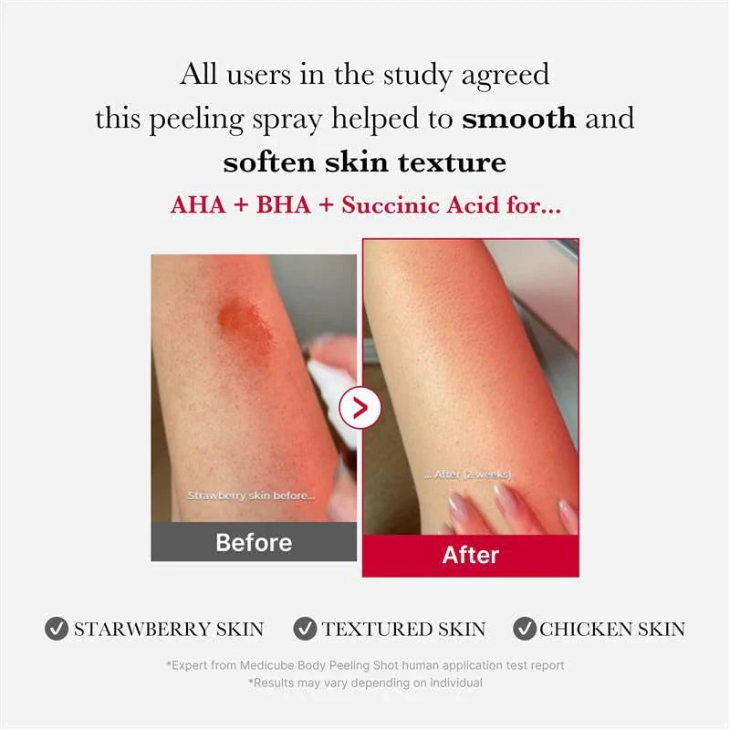 Buy MEDICUBE - Red Acne Body Peeling Shot - 110G in Pakistan