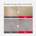 Buy MEDICUBE - Red Acne Body Peeling Shot - 110G in Pakistan