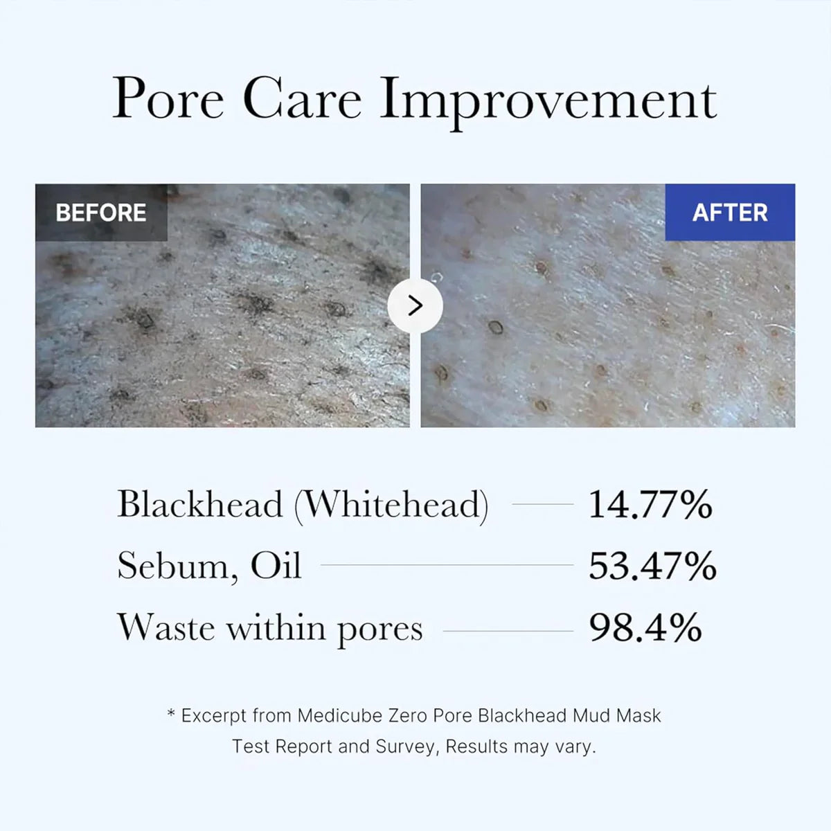 Buy MEDICUBE - Zero Pore Blackhead Mud Mask - 100G in Pakistan
