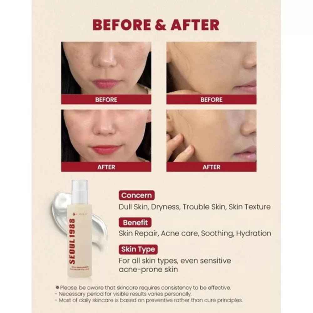 Buy K-SECRET SEOUL 1988 ESSENCE : SNAIL MUCIN 97% + RICE -100ml in Pakistan